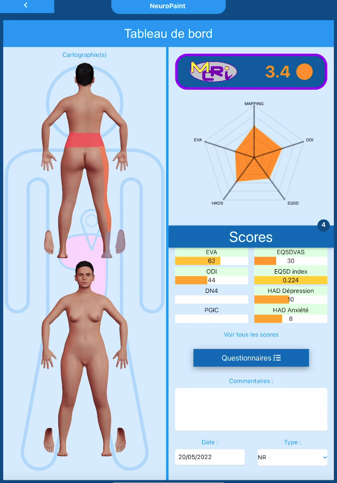 Capture d'écran du MCRI avec les différents scores