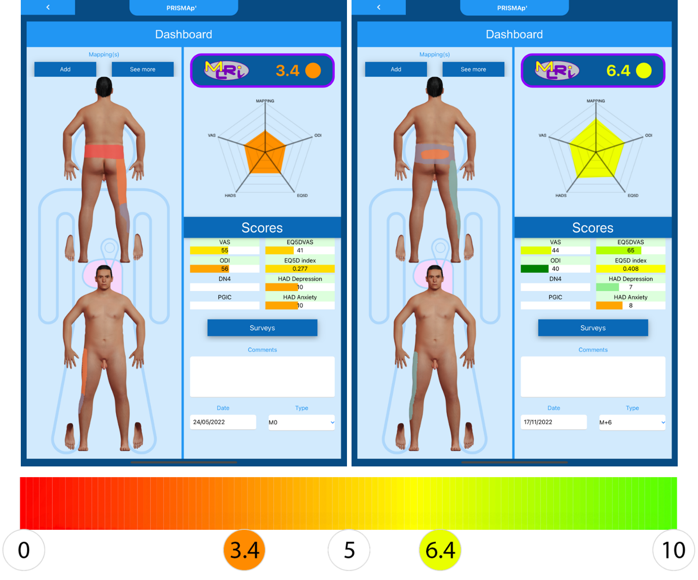 Capture d'écran du MCRI avec le score global calculé